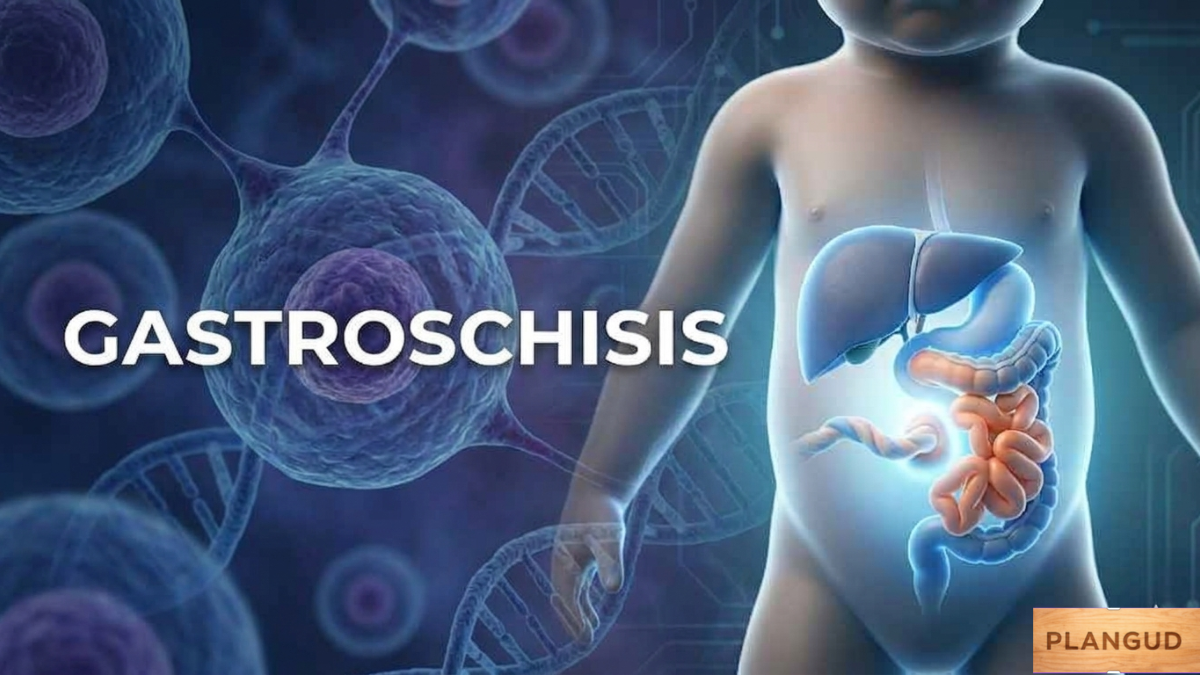 Gastroschisis: Risks, Treatment, and Prognosis